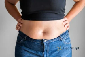 Bidding Farewell to Muffin Tops with Aqualyx Fat Injections 2 Do you wish you could reduce your muffin top Cambourne With Aqualy fat dissolving injections you can!